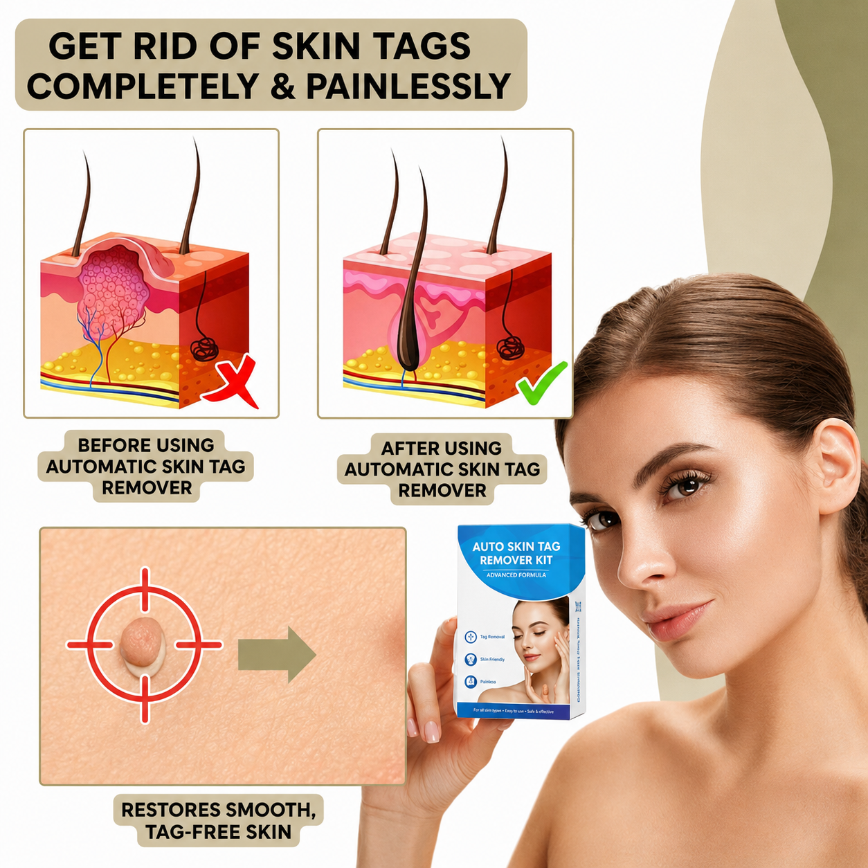 Wart Remover | Pain-Free Removal of Warts & Moles | For Home Use | No Surgery Required