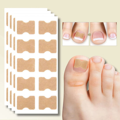 10+10 FREE | Instant Nail Repair Solution