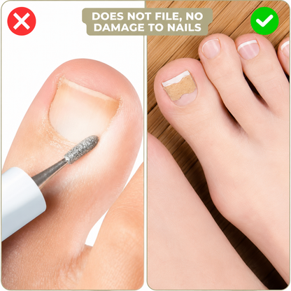 10+10 FREE | Instant Nail Repair Solution